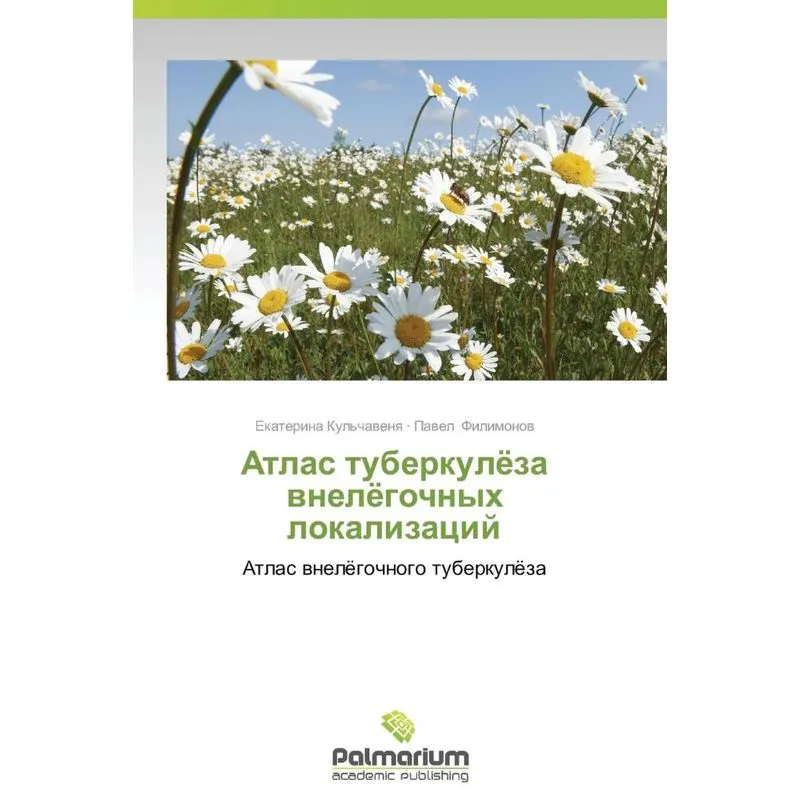 Atlas Tuberkulyeza Vnelyegochnykh Lokalizatsiy