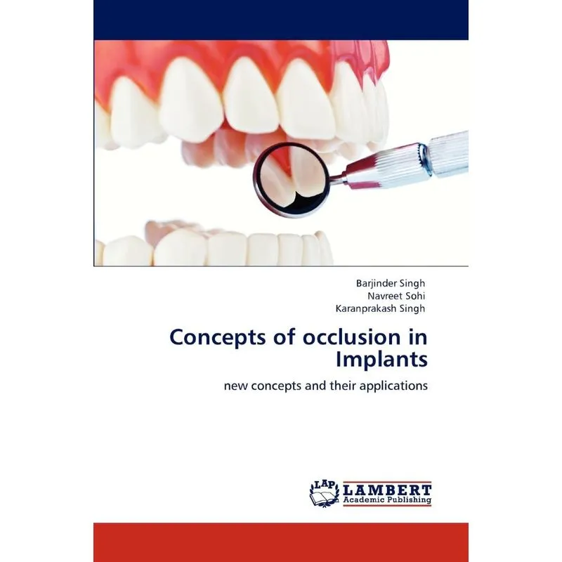 Concepts Of Occlusion In Implants