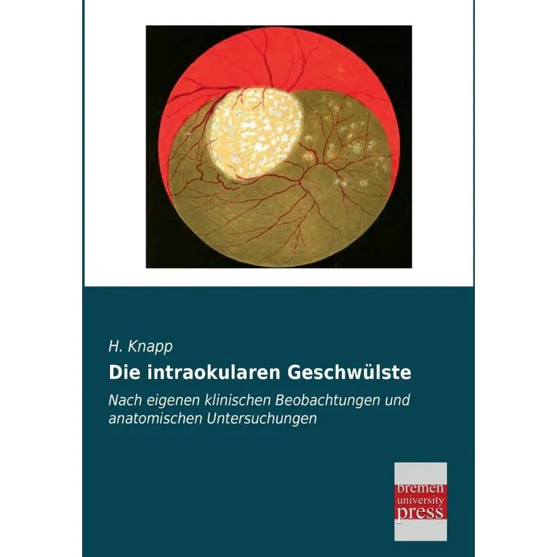 Die Intraokularen Geschwulste