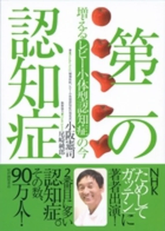 第二の認知症－増えるレビ−小体型認知症の今増えるレビ－小体型認知症の今