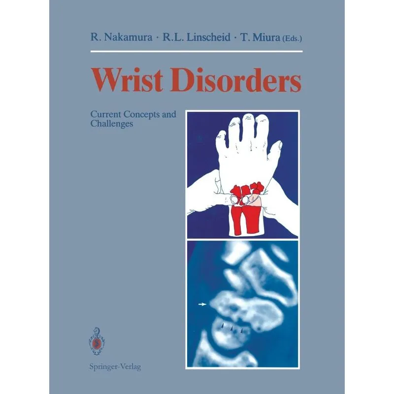 Wrist Disorders