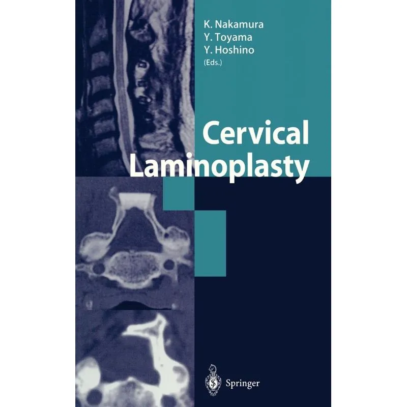 Cervical Laminoplasty