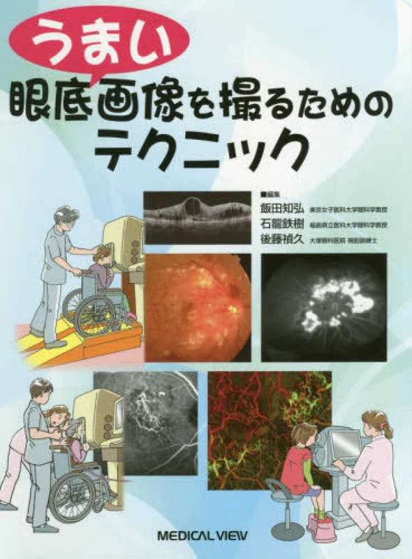 うまい眼底画像を撮るためのテクニック