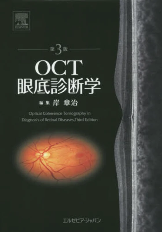 ＯＣＴ眼底診断学（第３版）
