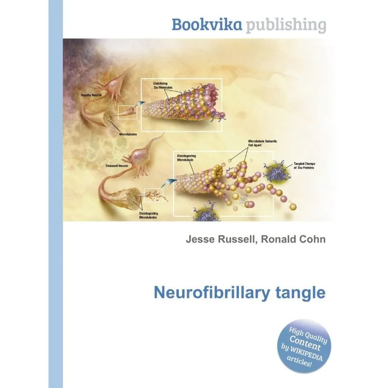 Neurofibrillary Tangle