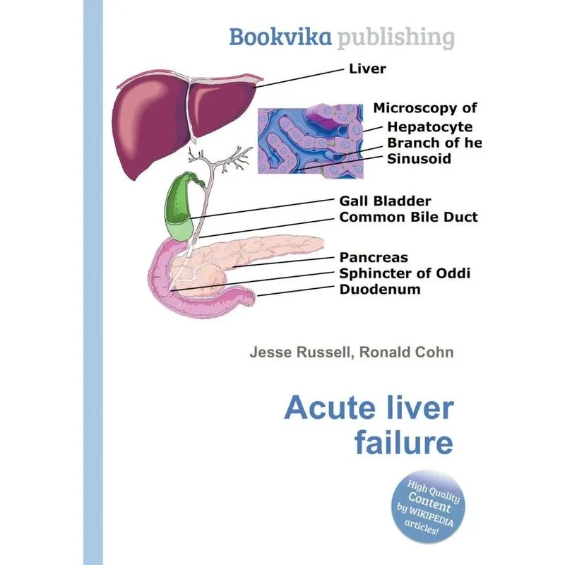 Acute liver failure