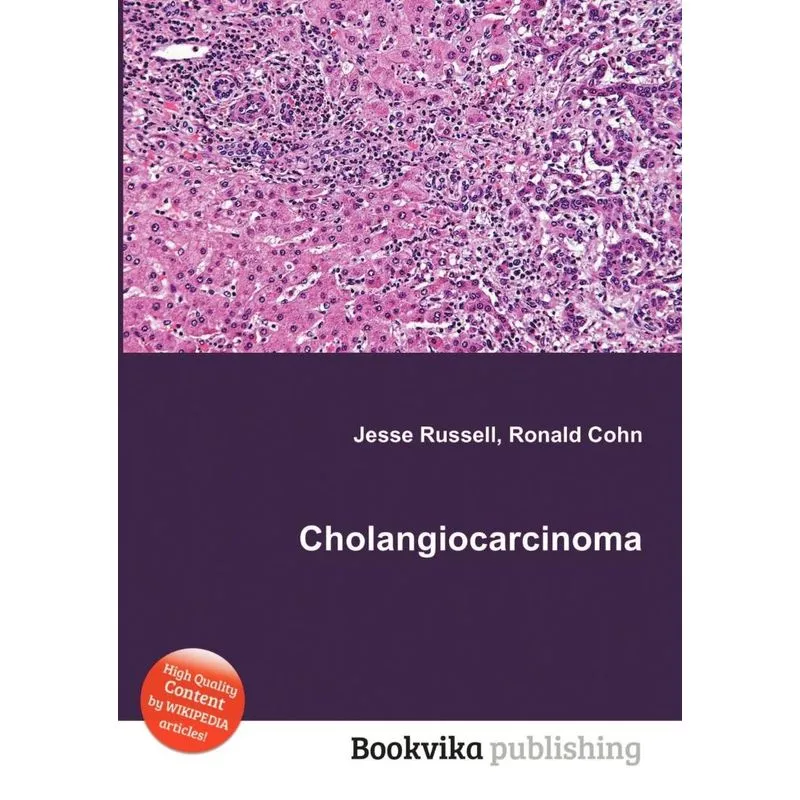 Cholangiocarcinoma