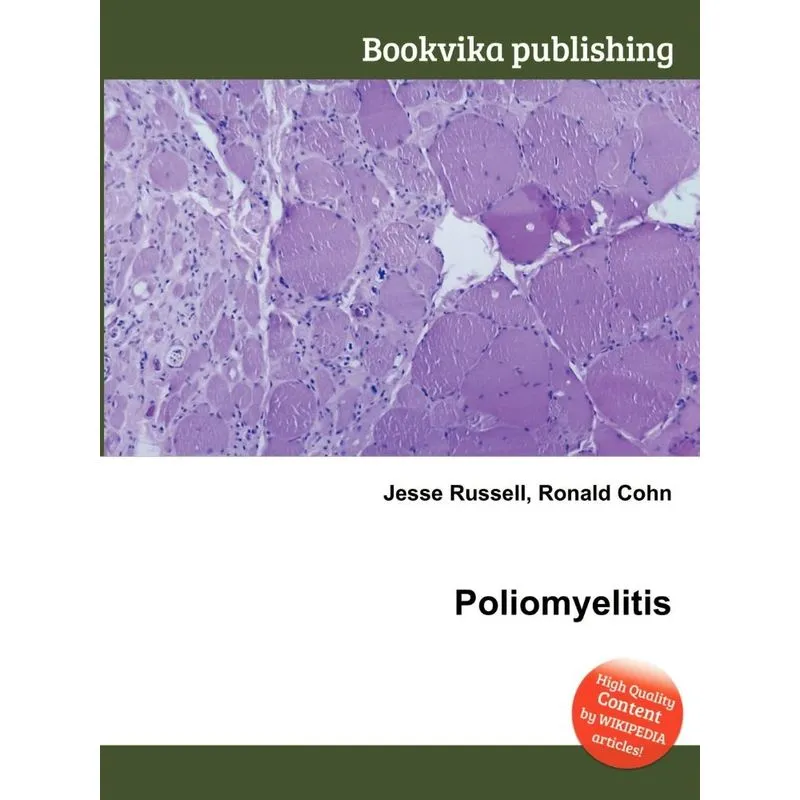 Poliomyelitis