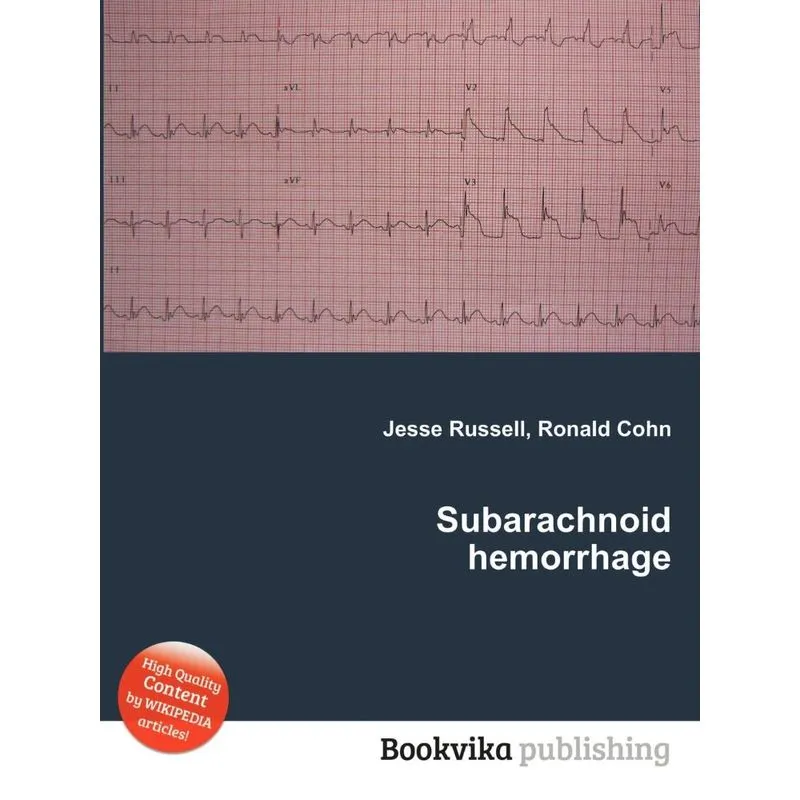 Subarachnoid Hemorrhage