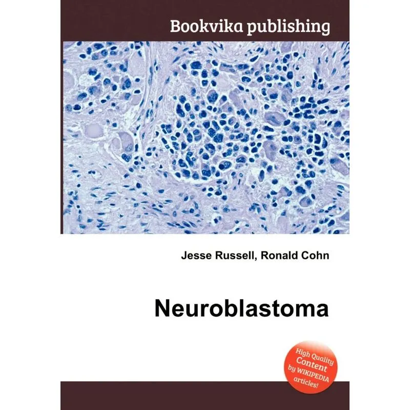 Neuroblastoma