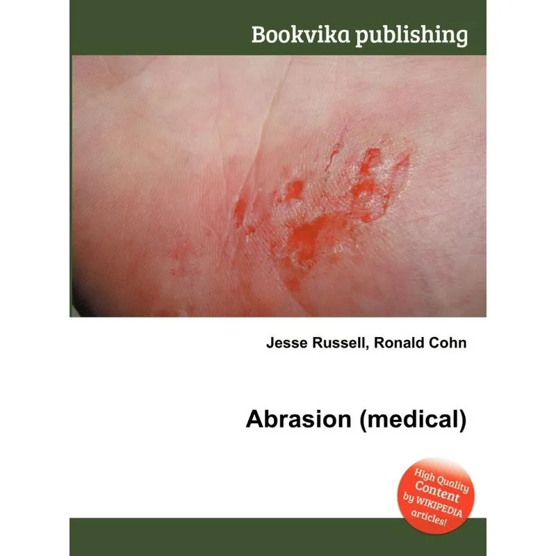 Abrasion (Medical)