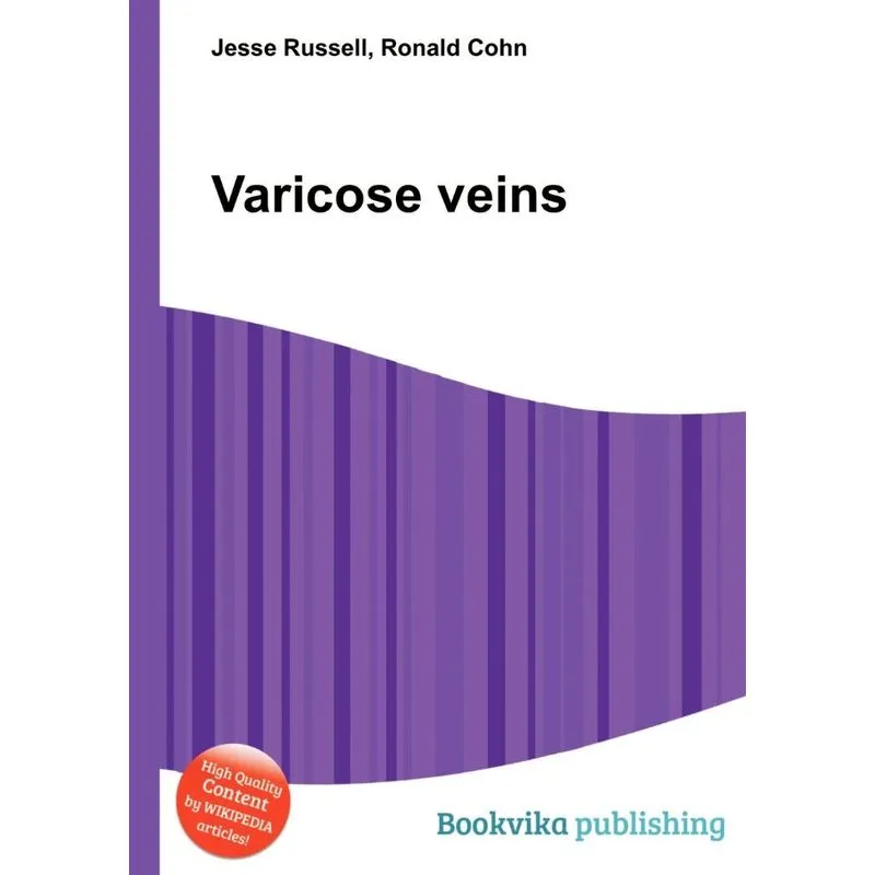 Varicose Veins