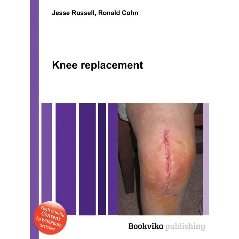 Knee Replacement