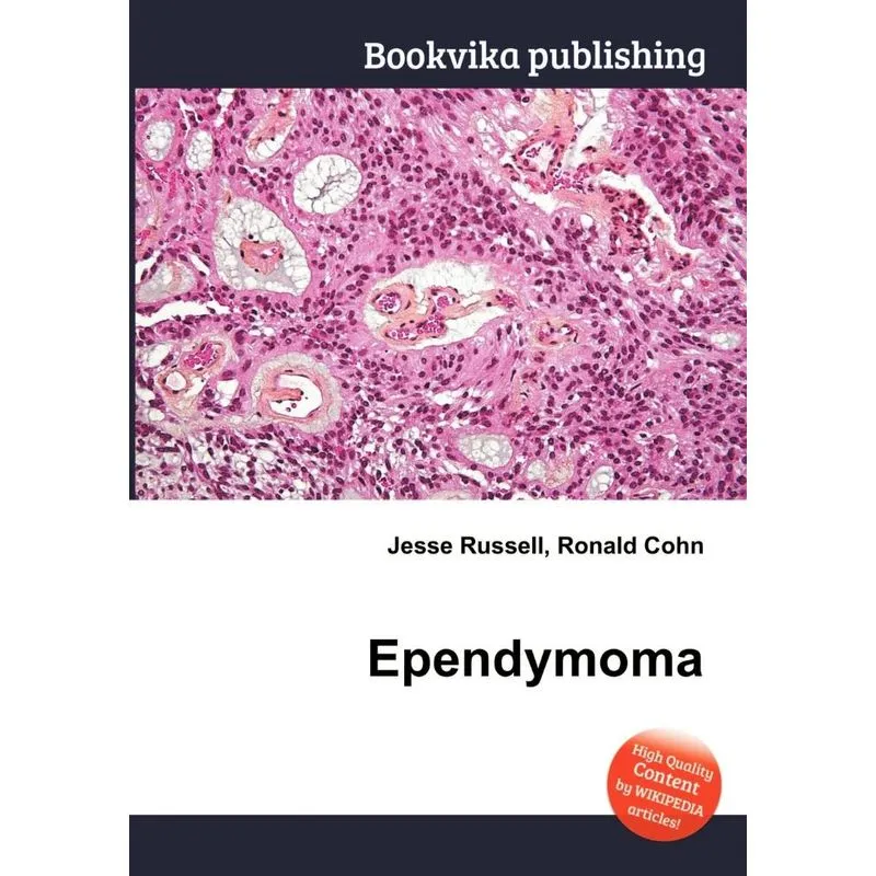 Ependymoma