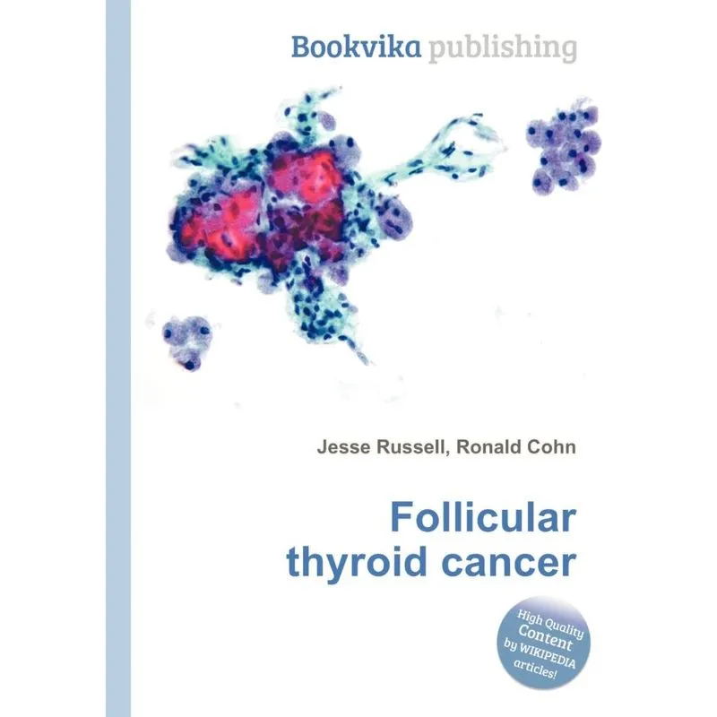 Follicular Thyroid Cancer