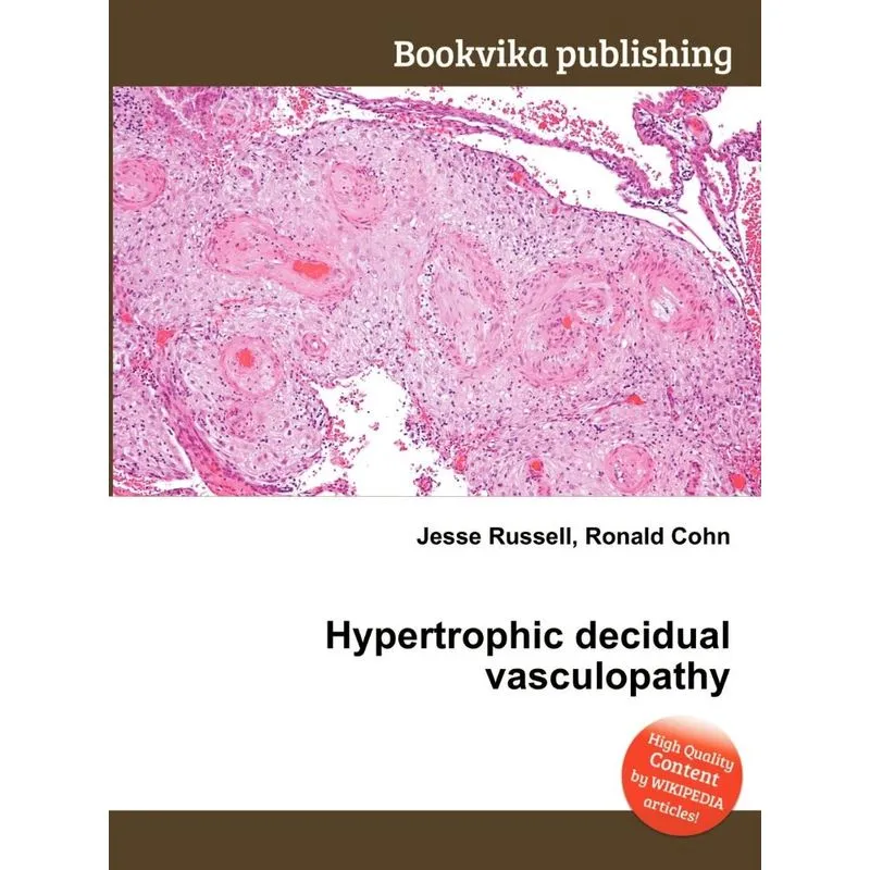 Hypertrophic Decidual Vasculopathy