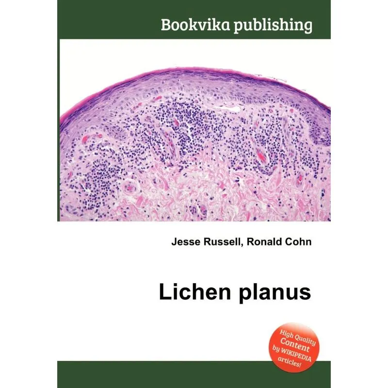 Lichen Planus