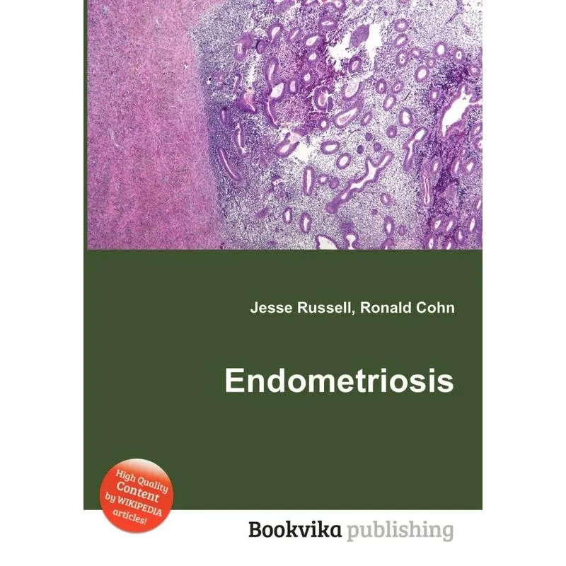 Endometriosis