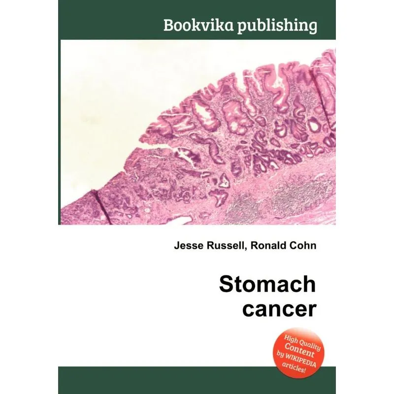 Stomach Cancer