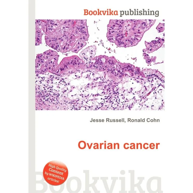 Ovarian Cancer