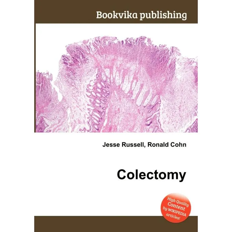 Colectomy