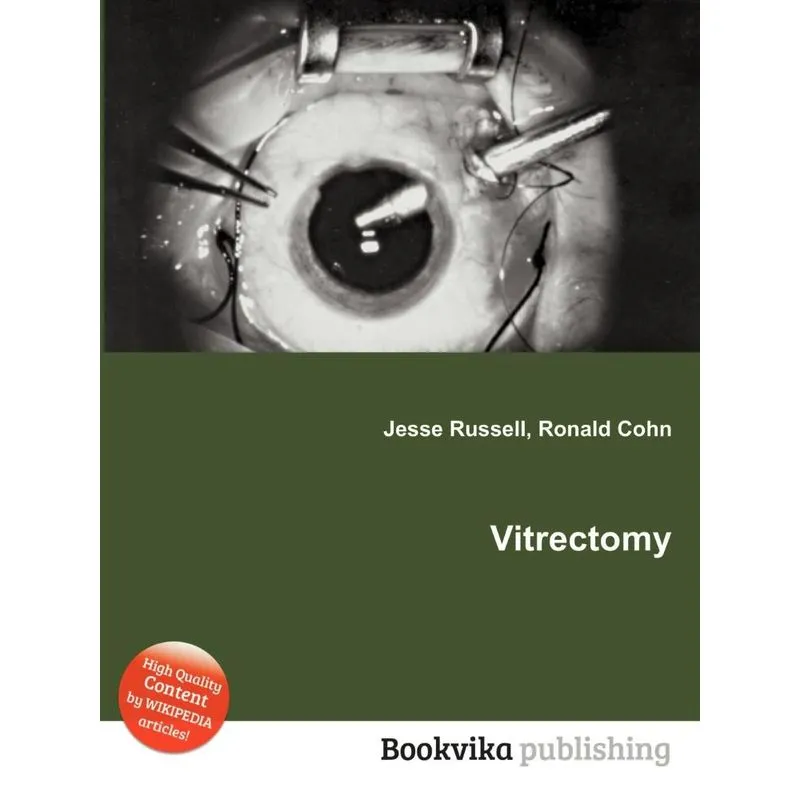 Vitrectomy
