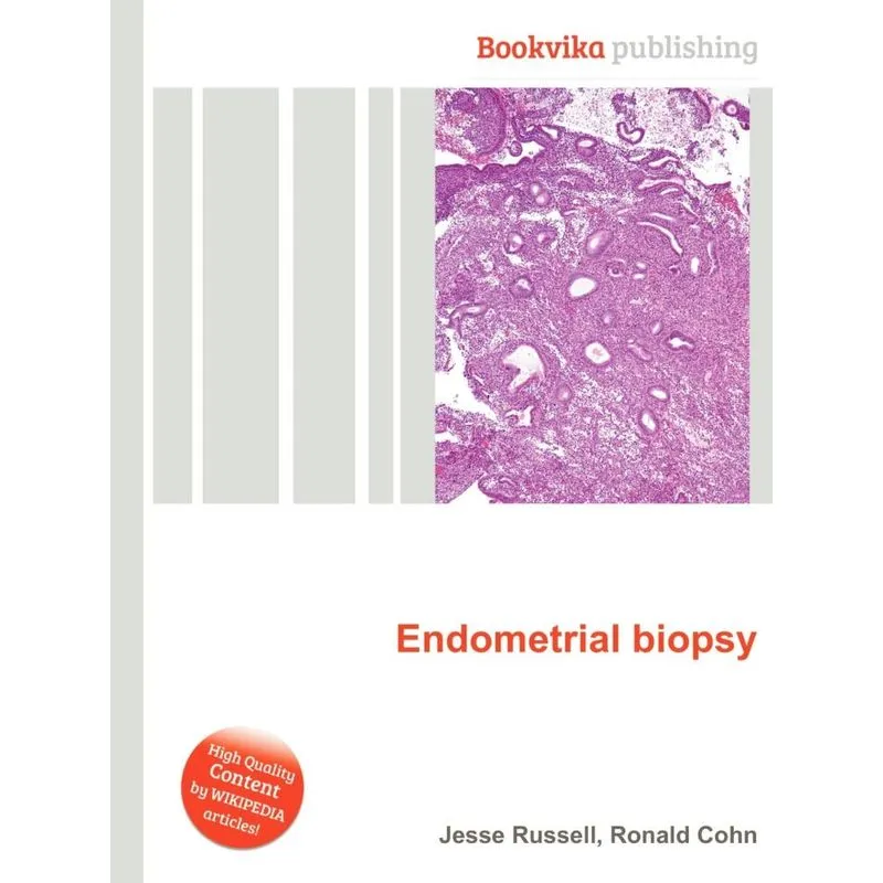 Endometrial Biopsy