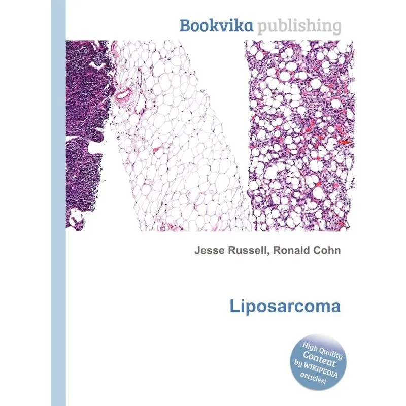 Liposarcoma