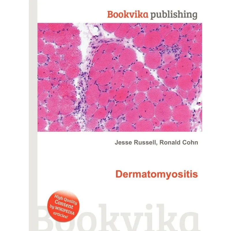 Dermatomyositis