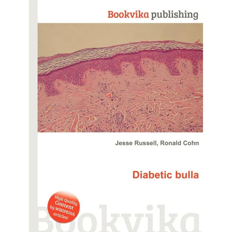 Diabetic Bulla