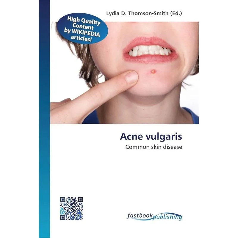 Acne vulgaris