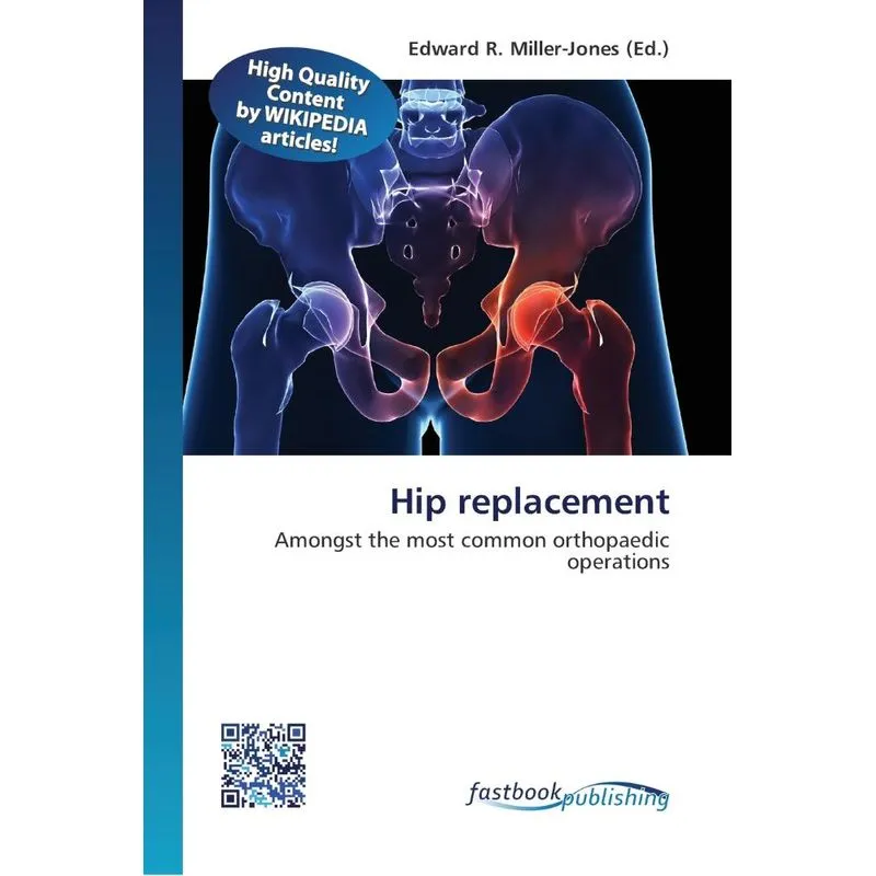 Hip replacement