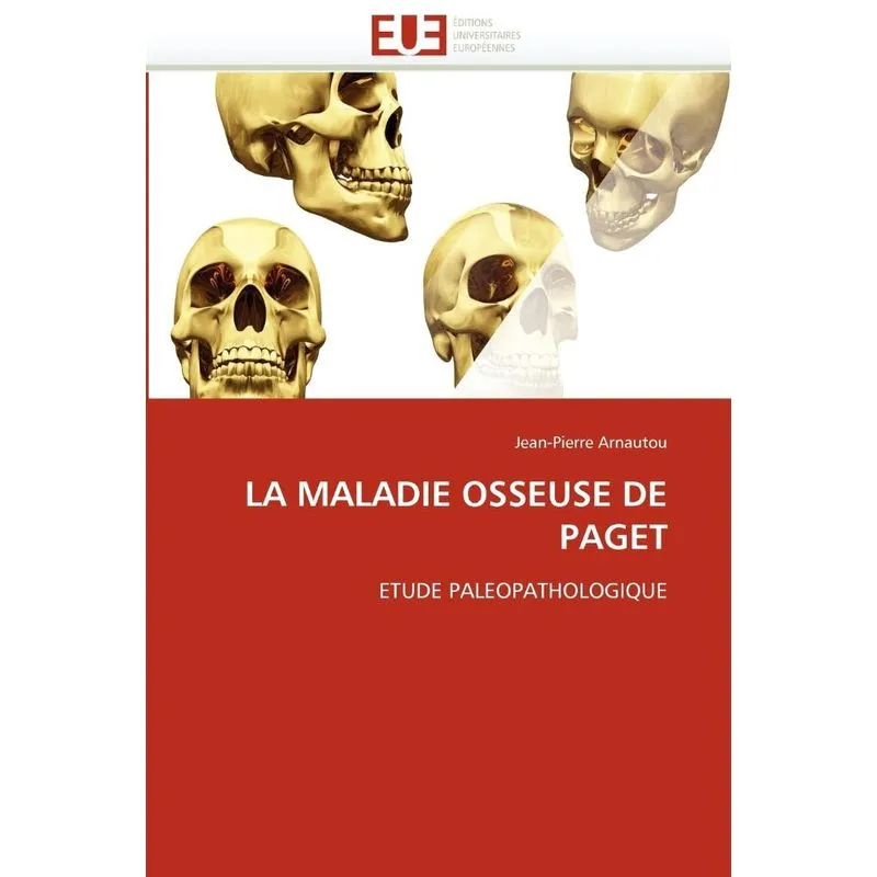 La maladie osseuse de paget