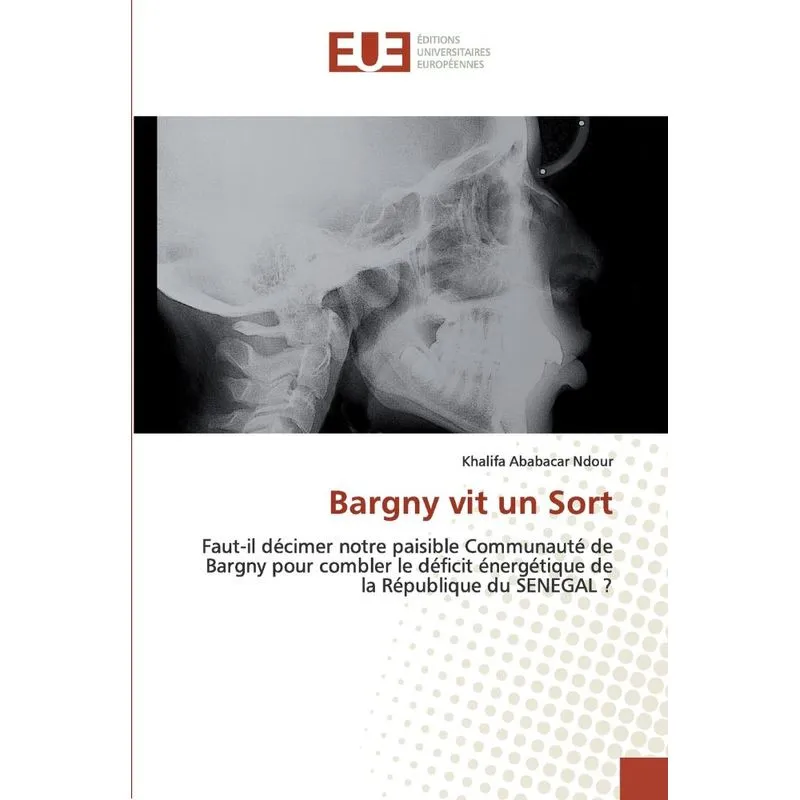 Bargny vit un Sort