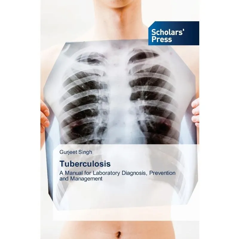 Tuberculosis