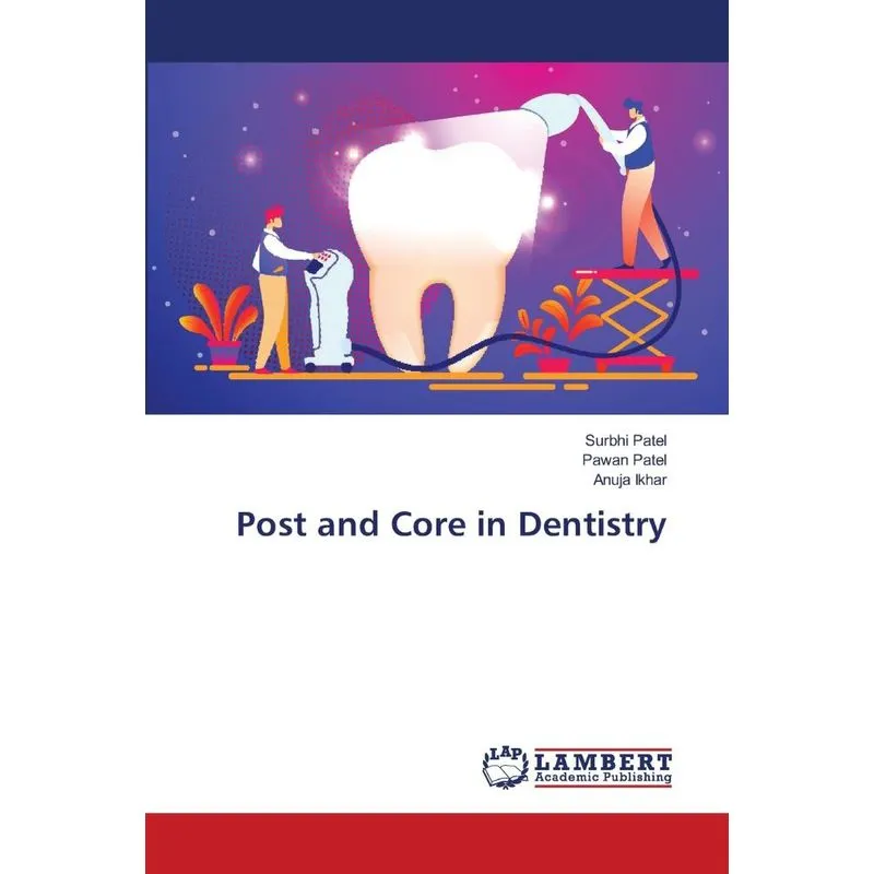 Post and Core in Dentistry