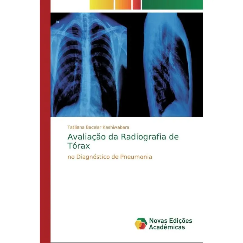 Avaliação da Radiografia de Tórax
