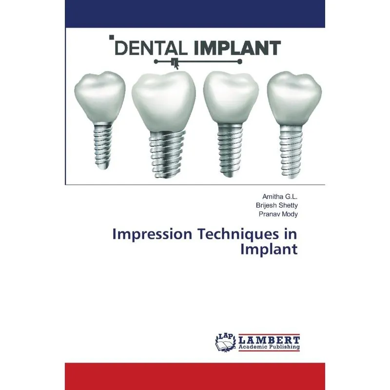 Impression Techniques in Implant