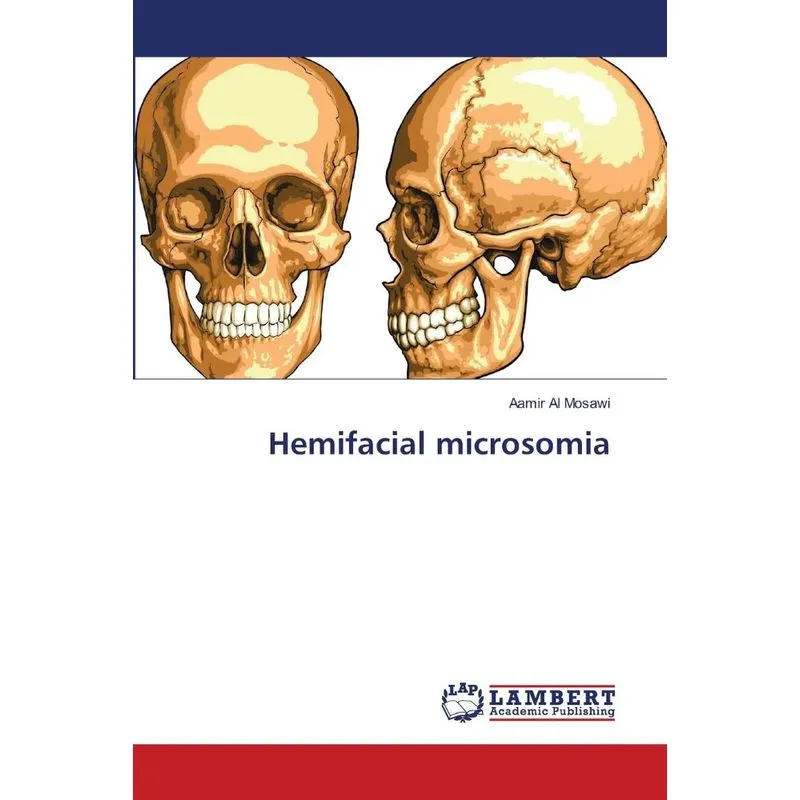 Hemifacial microsomia