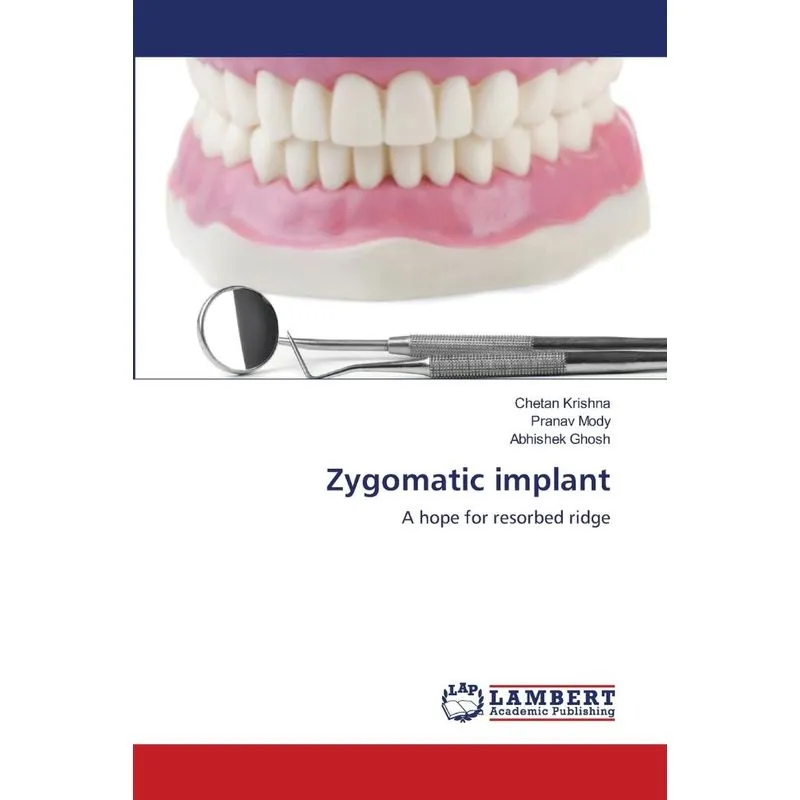Zygomatic implant