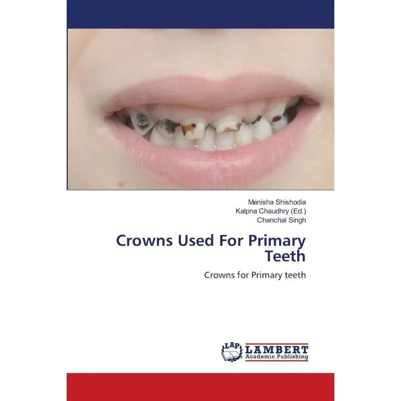 Crowns Used For Primary Teeth