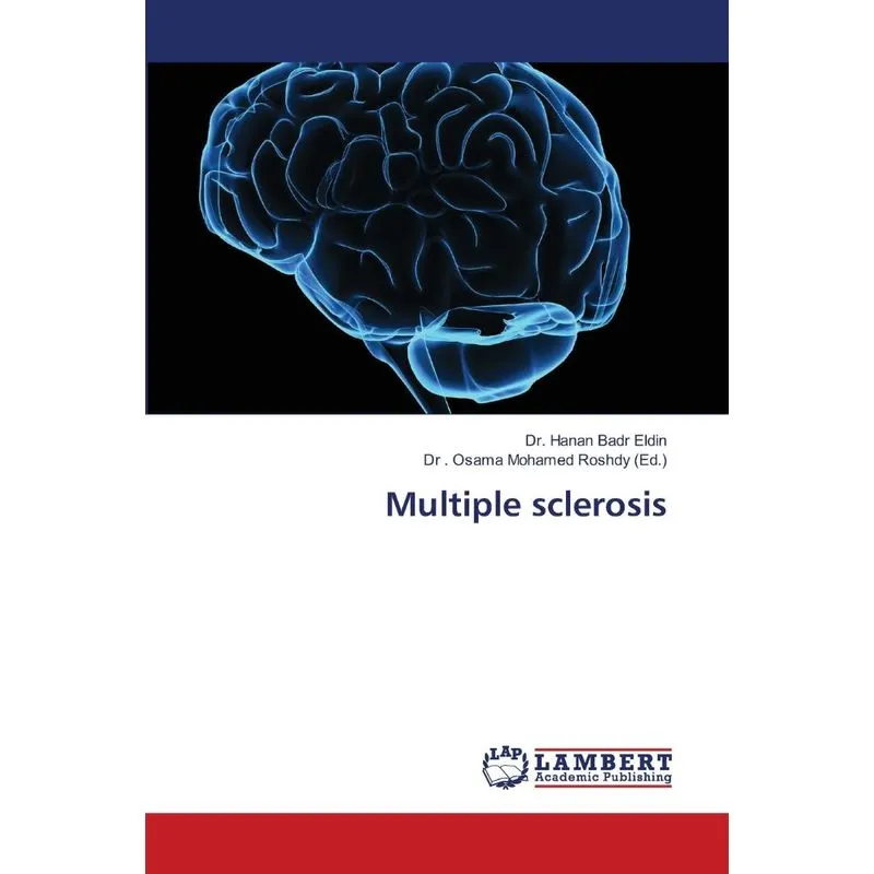Multiple sclerosis