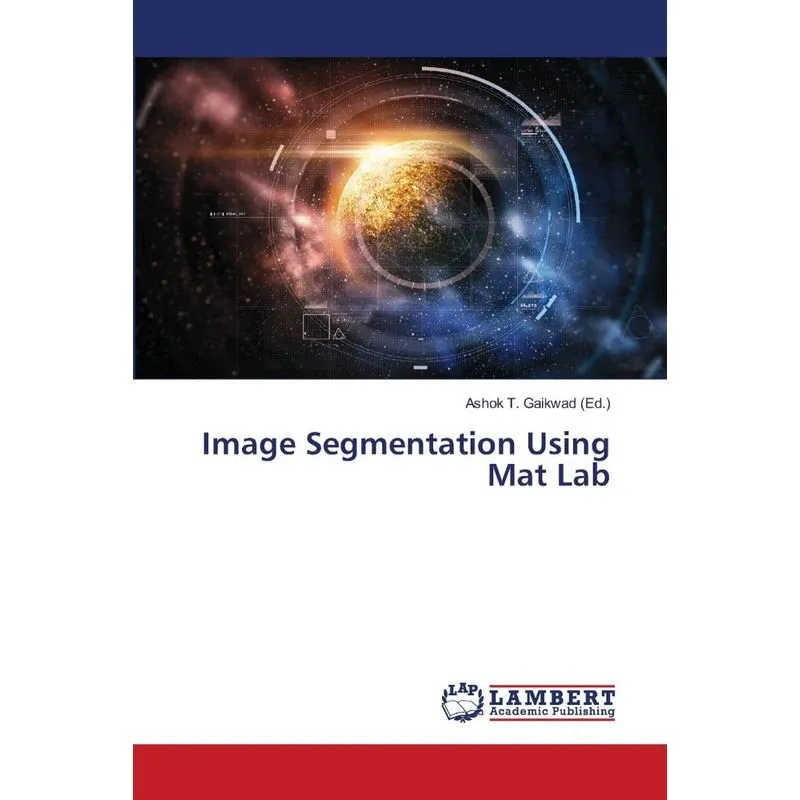Image Segmentation Using Mat Lab