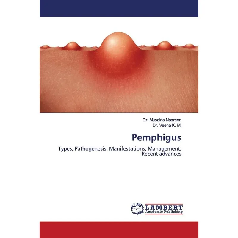 Pemphigus