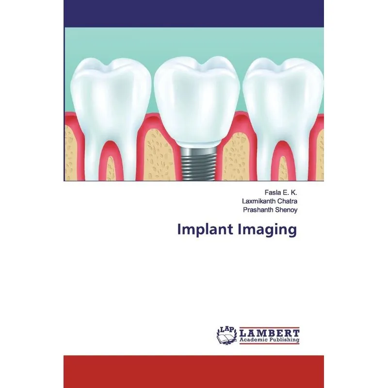 Implant Imaging