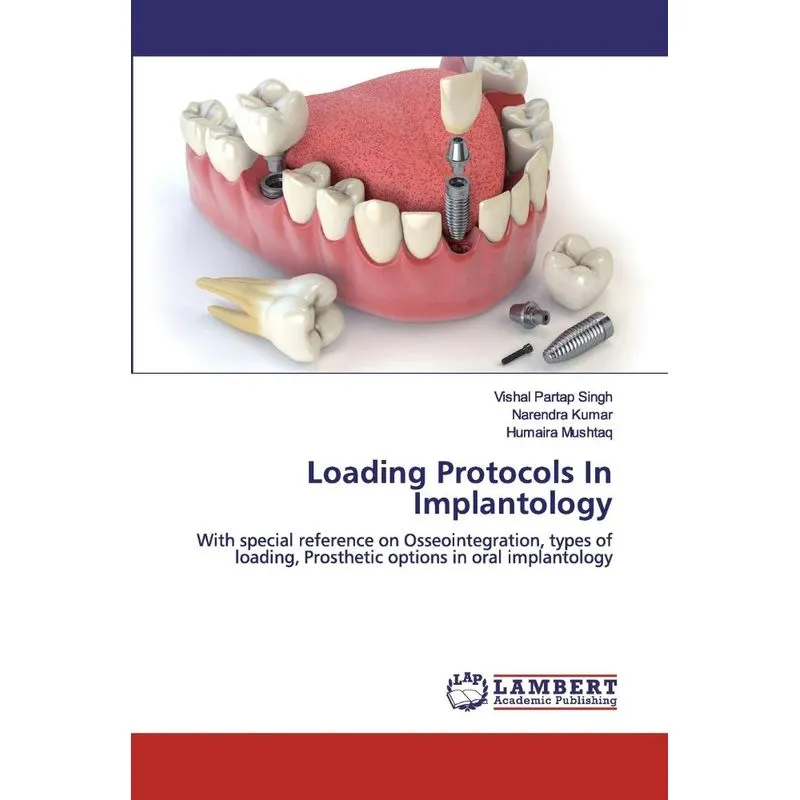 Loading Protocols In Implantology