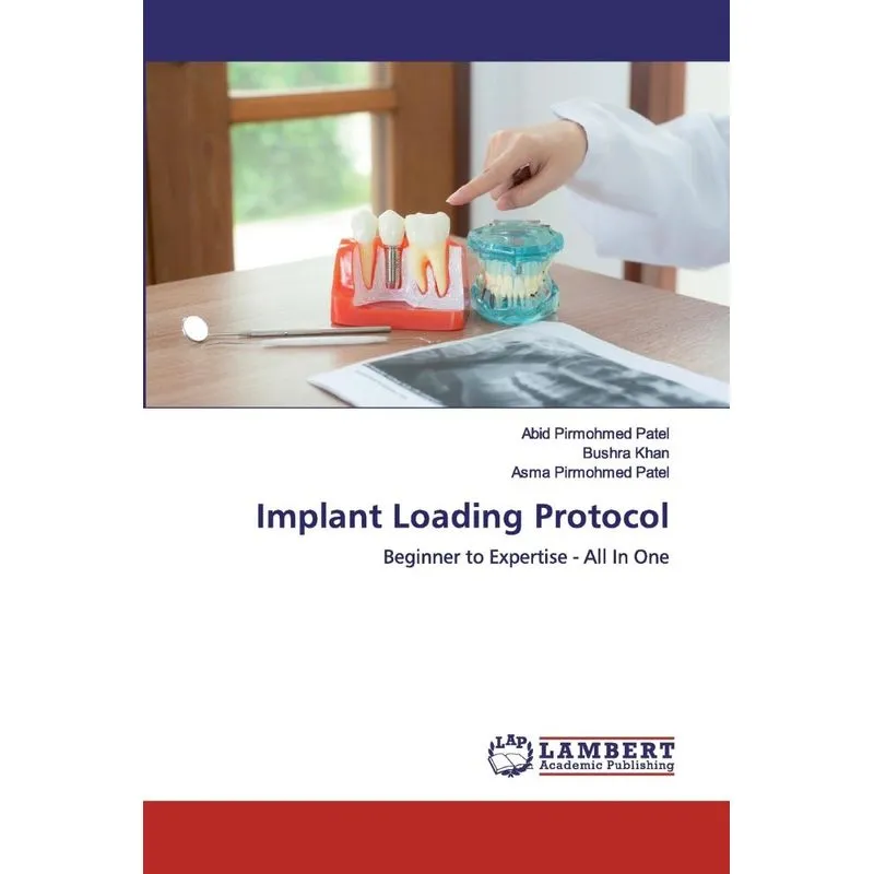 Implant Loading Protocol