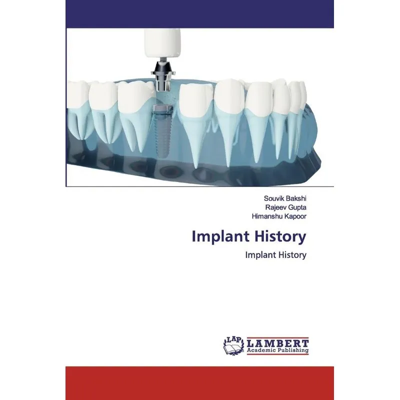 Implant History