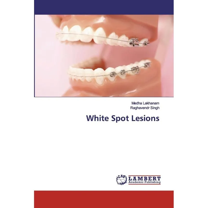 White Spot Lesions