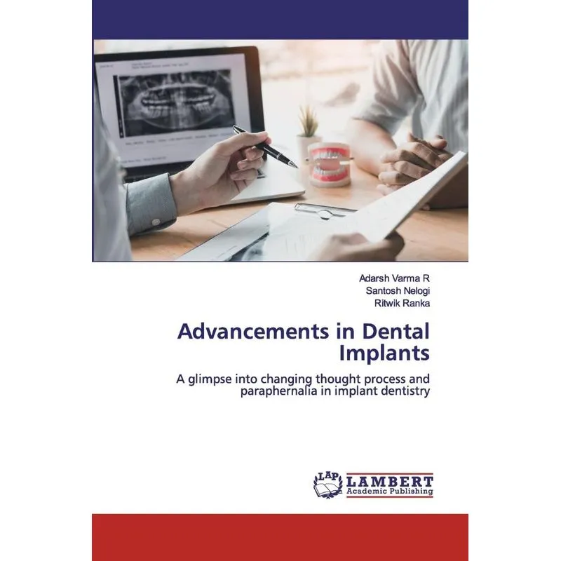 Advancements in Dental Implants